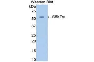 Detection of Recombinant AGT, Mouse using Polyclonal Antibody to Angiotensinogen (AGT)