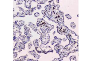 IHC testing of FFPE human placental tissue with DC-SIGN antibody at 1ug/ml. (DC-SIGN/CD209 anticorps)