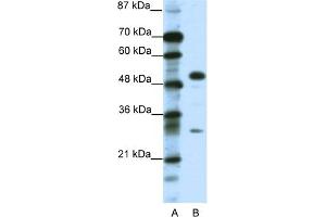 WB Suggested Anti-GCM1 Antibody Titration:  0. (GCM1 anticorps  (C-Term))