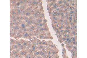 IHC-P analysis of Mouse Tissue, with DAB staining. (Vitamin D-Binding Protein anticorps  (AA 395-473))