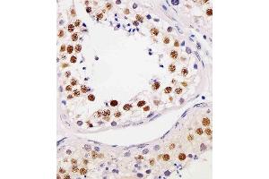 (ABIN6244015 and ABIN6577179) staining TE2IP in human testis tissue sections by Immunohistochemistry (IHC-P - paraformaldehyde-fixed, paraffin-embedded sections).