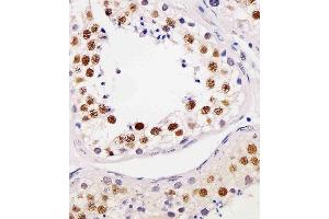 (ABIN6244015 and ABIN6577179) staining TE2IP in human testis tissue sections by Immunohistochemistry (IHC-P - paraformaldehyde-fixed, paraffin-embedded sections). (RAP1 anticorps  (AA 1-399))