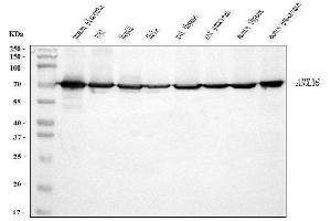 Western blot analysis of Annexin VI using anti-Annexin VI antibody (ABIN7601597).