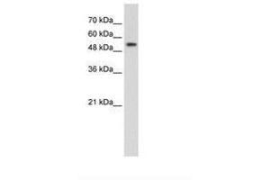 Image no. 2 for anti-Pre-mRNA Processing Factor 19 (PRPF19) (AA 151-200) antibody (ABIN203527) (PRP19 anticorps  (AA 151-200))