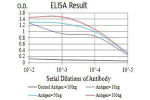 Black line: Control Antigen (100 ng),Purple line: Antigen (10 ng), Blue line: Antigen (50 ng), Red line:Antigen (100 ng)