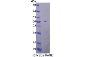 SDS-PAGE analysis of Mouse MRPL1 Protein. (MRPL1 Protéine)