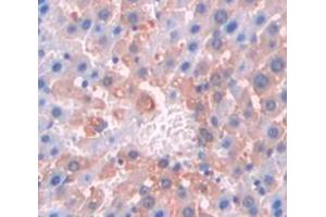 IHC-P analysis of Kidney tissue, with DAB staining. (Cortactin anticorps  (AA 1-509))