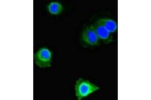 Immunofluorescent analysis of Hela cells using ABIN7150566 at dilution of 1:100 and Alexa Fluor 488-congugated AffiniPure Goat Anti-Rabbit IgG(H+L) (DOK2 anticorps  (AA 123-412))