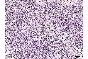 Formalin-fixed and paraffin embedded human lymph node tissue labeled with Anti-BRMS-1 Polyclonal Antibody, Unconjugated at 1:200 followed by conjugation to the secondary antibody and DAB staining (BRMS1L anticorps  (AA 151-246))