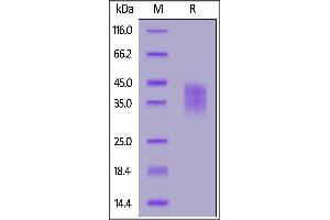 Rhesus macaque PD-1, His Tag on  under reducing (R) condition. (PD-1 Protein (AA 25-167) (His tag))