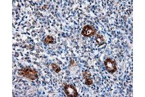 Image no. 1 for anti-L1 Cell Adhesion Molecule (L1CAM) antibody (ABIN1499082) (L1CAM anticorps)