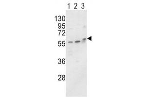 Western blot analysis of ALP / Alkaline Phosphatase antibody and MCF-7 (lane 1), HL-60 cell line (2) and mouse brain tissue (3) lysate.