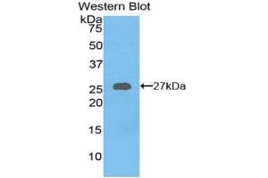 Detection of Recombinant AXIN, Mouse using Polyclonal Antibody to Axis Inhibition Protein (AXIN) (Axin anticorps  (AA 654-863))