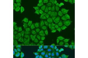 Immunofluorescence analysis of U2OS cells using STX12 Polyclonal Antibody at dilution of 1:100. (Syntaxin 12 anticorps)