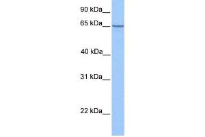 WB Suggested Anti-PML Antibody Titration:  1 ug/ml  Positive Control:  Hela cell lysate (PML anticorps  (C-Term))