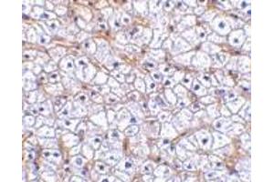 Immunohistochemistry of Fn14 in human liver tissue with Fn14 antibody at 2. (TNFRSF12A anticorps)