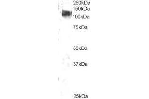 ABIN2561614 staining (2µg/ml) of 3T3 lysate (RIPA buffer, 35µg total protein per lane). (CBL anticorps  (C-Term))