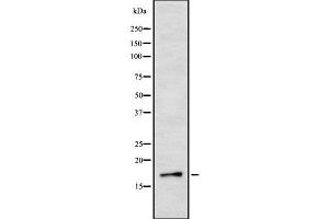 Western blot analysis IL3 using Jurkat whole cell lysates (IL-3 anticorps  (Internal Region))