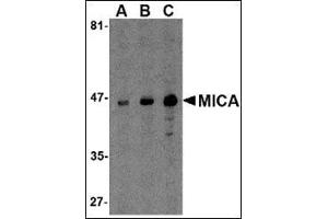 Western blot analysis of MICA in A-20 cell lysate with this product at (A) 0. (MICA anticorps  (C-Term))