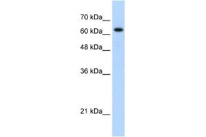 WB Suggested Anti-RAD17 Antibody Titration: 1. (RAD17 anticorps  (C-Term))