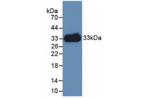 Western blot analysis of recombinant Human LAMC1. (Laminin gamma 1 anticorps  (AA 521-772))