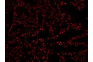 Immunofluorescence (IF) image for anti-5'-3' Exoribonuclease 2 (XRN2) (AA 900-950) antibody (ABIN7449038) (XRN2 anticorps  (AA 900-950))