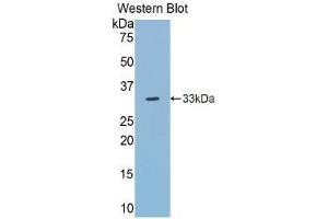 Western Blotting (WB) image for anti-Toll-Like Receptor 5 (TLR5) (AA 303-514) antibody (ABIN1860772) (TLR5 anticorps  (AA 303-514))