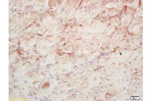 Formalin-fixed and paraffin embedded rat cardiac muscle labeled with Rabbit Anti AMP deaminase 1 Polyclonal Antibody, Unconjugated (ABIN873205) at 1:200 followed by conjugation to the secondary antibody and DAB staining