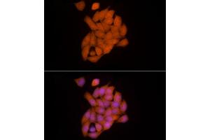 Immunofluorescence analysis of HeLa cells using Ube2L3 / UBCH7 Rabbit mAb (ABIN7271178) at dilution of 1:25 (40x lens). (UBE2L3 anticorps)
