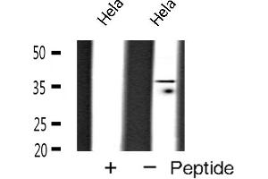 Western blot analysis of TBP expression in Hela cells (TBP anticorps  (N-Term))