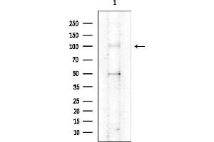 Western blot analysis of lysates from COLO205 cells(heat-shock treatment), using ATP12A Antibody at 1/1000 dilution.