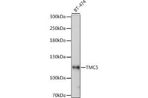 Western blot analysis of extracts of BT-474 cells, using TMC5 antibody (ABIN7270941) at 1:1000 dilution. (Tmc5 anticorps  (AA 676-760))