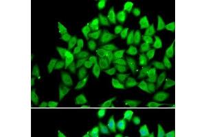 Immunofluorescence analysis of A549 cells using ALS2 Polyclonal Antibody (ALS2 anticorps)