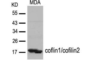 Image no. 2 for anti-Cofilin 1 (CFL1) (Tyr88) antibody (ABIN319382) (Cofilin anticorps  (Tyr88))