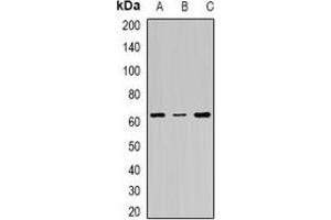 Western blot analysis of FANCC expression in Jurkat (A), Hela (B), mouse intestin (C) whole cell lysates. (FANCC anticorps)