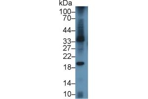 Detection of LAB7-1 in Mouse Spleen lysate using Polyclonal Antibody to B-Lymphocyte Activation Antigen B7-1 (LAB7-1) (CD80 anticorps  (AA 38-246))