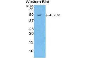 Western blot analysis of the recombinant protein. (HYAL1 anticorps  (AA 52-462))
