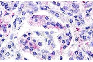 Image no. 1 for anti-G Protein-Coupled Receptor 119 (GPR119) (Cytoplasmic Domain) antibody (ABIN1048700)