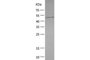 Western Blotting (WB) image for Caspase Recruitment Domain Family, Member 14 (CARD14) (AA 2-434) protein (His tag) (ABIN7122172)