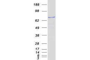 Validation with Western Blot