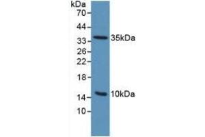 Detection of uPAR in Mouse Sp2/0 Cells using Polyclonal Antibody to Plasminogen Activator, Urokinase Receptor (uPAR) (PLAUR anticorps  (AA 13-114))