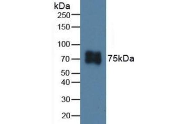 ITGB6 anticorps  (AA 131-371)