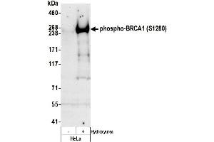 Western Blotting (WB) image for anti-Breast Cancer 1 (BRCA1) (pSer1280) antibody (ABIN7452574)