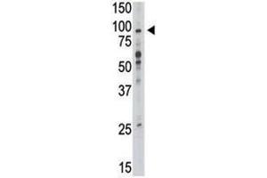 Western blot analysis of TLR6 antibody and mouse liver tissue lysate