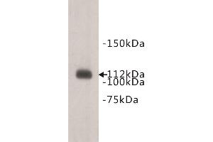 Western Blotting (WB) image for anti-Transmembrane Protein 67 (TMEM67) antibody (ABIN1854943) (TMEM67 anticorps)