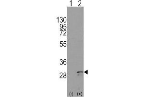 Western Blotting (WB) image for anti-KIT Ligand (KITLG) antibody (ABIN2998288) (KIT Ligand anticorps)