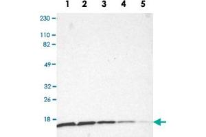 Western Blot analysis of Lane 1: RT-4, Lane 2: U-251MG sp, Lane 3: A-431, Lane 4: human liver and Lane 5: human tonsil lysates with RPS20 polyclonal antibody . (RPS20 anticorps)