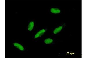 Immunofluorescence of purified MaxPab antibody to HIC2 on HepG2 cell.