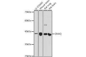 Western blot analysis of extracts of various cell lines, using GNAQ antibody (ABIN7267542) at 1:500 dilution. (GNAQ anticorps  (AA 1-359))