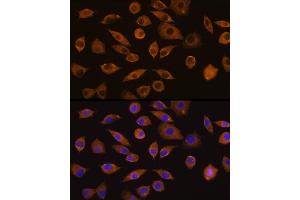 Immunofluorescence analysis of L929 cells using DOCK2 Rabbit pAb (ABIN1679578, ABIN5664348 and ABIN5664349) at dilution of 1:100 (40x lens).